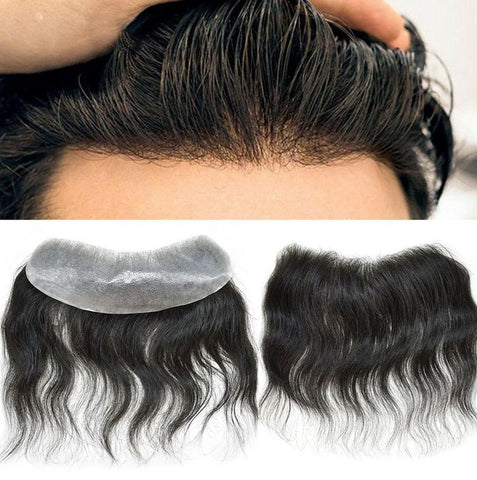 Front Hair-Line Patch