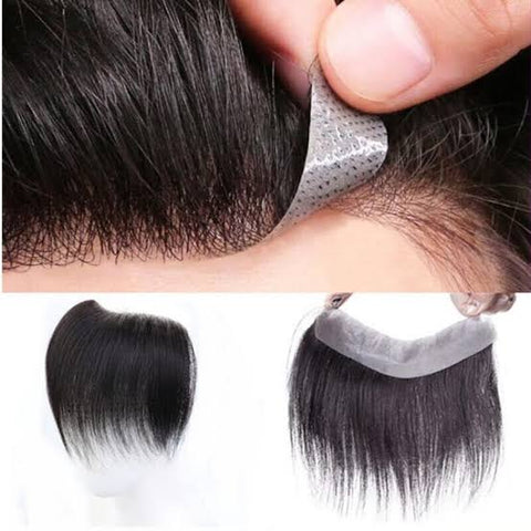 Front Hair-Line Patch