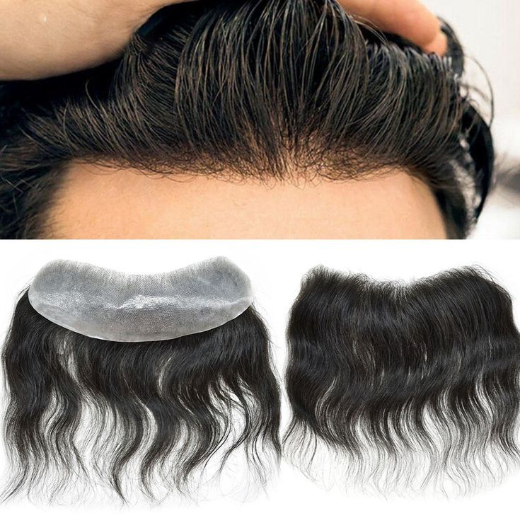 Front Hair-Line Patch