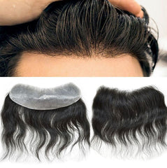 Front Hair-Line Patch